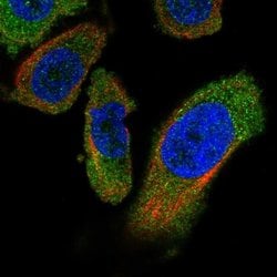 Invitrogen PANK4 Polyclonal Antibody 100 &mu;L; Unconjugated:Antibodies,