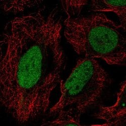 Invitrogen DUSP27 Polyclonal Antibody 100 &mu;L; Unconjugated:Antibodies,