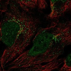 Invitrogen GGT7 Polyclonal Antibody 100 &mu;L; Unconjugated:Antibodies,