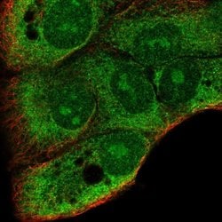 Invitrogen DDRGK1 Polyclonal Antibody 100 &mu;L; Unconjugated:Antibodies,