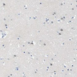 Invitrogen Opsin Blue Polyclonal Antibody 100 &mu;L; Unconjugated:Antibodies,