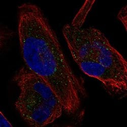 Invitrogen KCNH1 Polyclonal Antibody 100 &mu;L; Unconjugated:Antibodies,