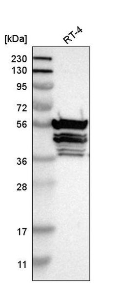 Invitrogen TMCO4 Polyclonal Antibody 100 &mu;L | Buy Online | Invitrogen&trade; | Fisher Scientific
