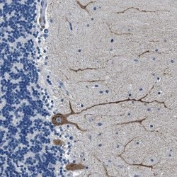 Invitrogen Connexin 46 Polyclonal Antibody 100 &mu;L; Unconjugated:Antibodies,