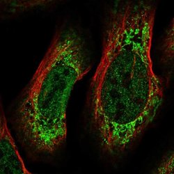 CREB3L2 Polyclonal Antibody, Invitrogen 100 &mu;L; Unconjugated:Antibodies,