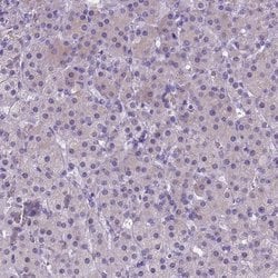 NEUROD4 Polyclonal Antibody:Antibodies, Polyclonal