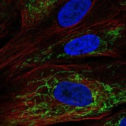 Invitrogen MGARP Polyclonal Antibody 100 &mu;L; Unconjugated:Antibodies,
