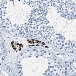 Invitrogen MGARP Polyclonal Antibody 100 &mu;L; Unconjugated:Antibodies,