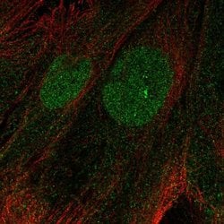 Invitrogen PHF11 Polyclonal Antibody 100 &mu;L; Unconjugated:Antibodies,
