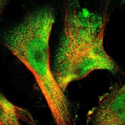 Invitrogen Sorcin Polyclonal Antibody 100 &mu;L; Unconjugated:Antibodies,