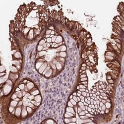 Invitrogen Sorcin Polyclonal Antibody 100 &mu;L; Unconjugated:Antibodies,