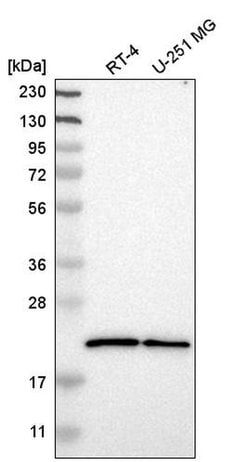 Invitrogen Sorcin Polyclonal Antibody 100 &mu;L; Unconjugated:Antibodies,