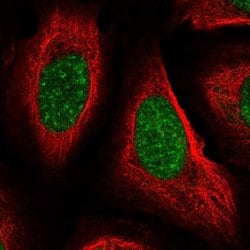 Invitrogen Cyclophilin E Polyclonal Antibody 100 &mu;L; Unconjugated:Antibodies,