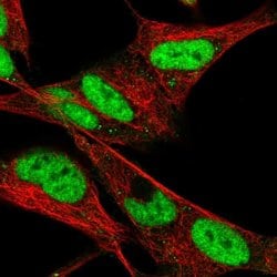 Invitrogen HAND2 Polyclonal Antibody 100 &mu;L; Unconjugated:Antibodies,
