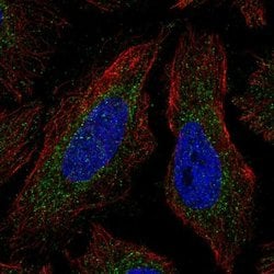 Invitrogen COQ4 Polyclonal Antibody 100 &mu;L; Unconjugated:Antibodies,