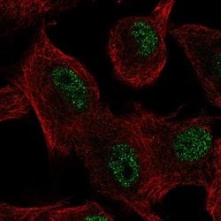 Invitrogen ZIP11 Polyclonal Antibody 100 &mu;L; Unconjugated:Antibodies,