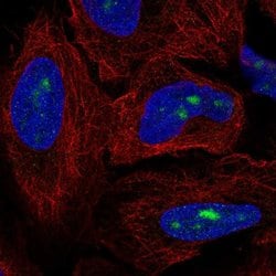 Invitrogen ZNF286A Polyclonal Antibody 100 &mu;L; Unconjugated:Antibodies,