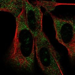 Invitrogen MAD2L2 Polyclonal Antibody 100 &mu;L; Unconjugated:Antibodies,