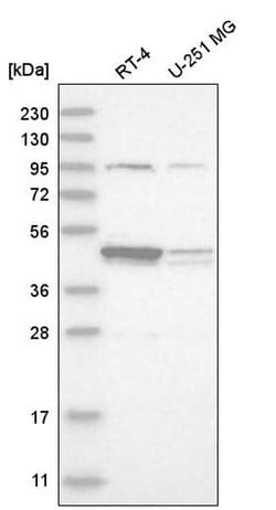Invitrogen DSCC1 Polyclonal Antibody 100 &mu;L; Unconjugated:Antibodies,