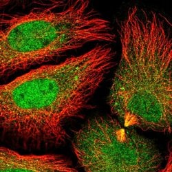 Invitrogen DNAJC8 Polyclonal Antibody 100 &mu;L; Unconjugated:Antibodies,