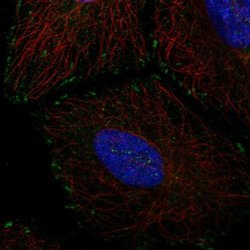 Invitrogen EMC4 Polyclonal Antibody 100 &mu;L | Buy Online | Invitrogen&trade; | Fisher Scientific