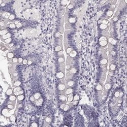 Invitrogen IMPG1 Polyclonal Antibody 100 &mu;L; Unconjugated:Antibodies,