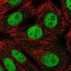 Invitrogen RNF220 Polyclonal Antibody 100 &mu;L; Unconjugated:Antibodies,