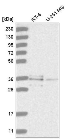Invitrogen RNF220 Polyclonal Antibody 100 &mu;L; Unconjugated:Antibodies,
