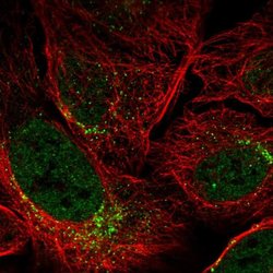 Invitrogen SPATA6 Polyclonal Antibody 100 &mu;L; Unconjugated:Antibodies,