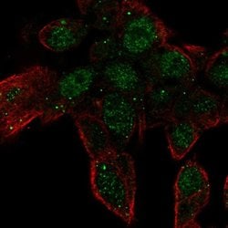 Invitrogen ZNF232 Polyclonal Antibody 100 &mu;L; Unconjugated:Antibodies,