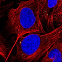 GRK4 Polyclonal Antibody:Antibodies, Polyclonal