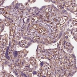 HTR1B Polyclonal Antibody, Invitrogen 100 &mu;L; Unconjugated:Antibodies,