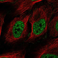 Invitrogen RAD52 Polyclonal Antibody 100 &mu;L; Unconjugated:Antibodies,