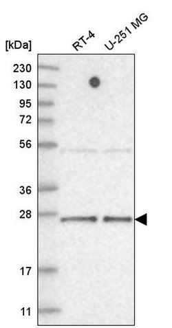 Invitrogen TAF11 Polyclonal Antibody 100 &mu;L | Buy Online | Invitrogen&trade; | Fisher Scientific