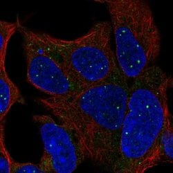 Invitrogen TBX1 Polyclonal Antibody 100 &mu;L; Unconjugated:Antibodies,