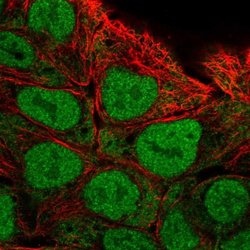 Invitrogen Calpain 13 Polyclonal Antibody 100 &mu;L; Unconjugated:Antibodies,