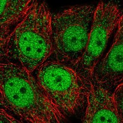 Invitrogen OAZ3 Polyclonal Antibody 100 &mu;L; Unconjugated:Antibodies,