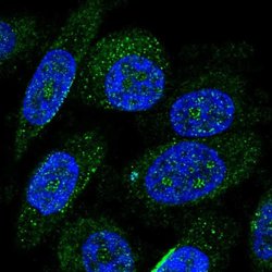 Invitrogen ZNF586 Polyclonal Antibody 100 &mu;L; Unconjugated:Antibodies,