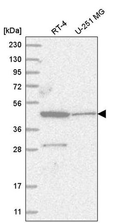 Invitrogen ZNF586 Polyclonal Antibody 100 &mu;L; Unconjugated:Antibodies,