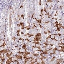 Invitrogen IMPG1 Polyclonal Antibody 100 &mu;L | Buy Online | Invitrogen&trade; | Fisher Scientific