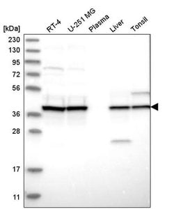Invitrogen UROD Polyclonal Antibody 100 &mu;L; Unconjugated:Antibodies,
