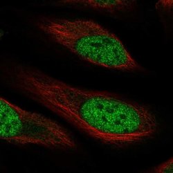 Invitrogen RHBDL1 Polyclonal Antibody 100 &mu;L; Unconjugated:Antibodies,