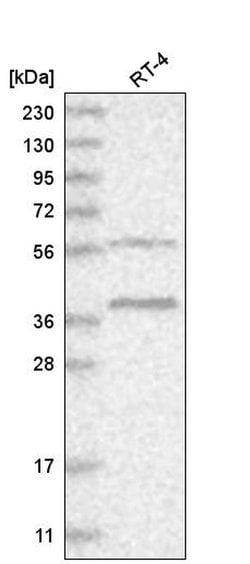 Invitrogen RHBDL1 Polyclonal Antibody 100 &mu;L; Unconjugated:Antibodies,