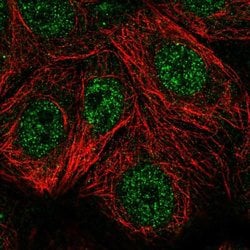 Invitrogen TSPAN17 Polyclonal Antibody 100 &mu;L; Unconjugated:Antibodies,