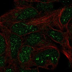 Invitrogen TRMT11 Polyclonal Antibody 100 &mu;L; Unconjugated:Antibodies,