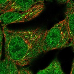 Invitrogen TNFAIP2 Polyclonal Antibody 100 &mu;L; Unconjugated:Antibodies,