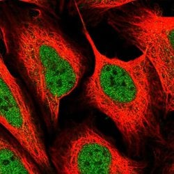 Invitrogen MED6 Polyclonal Antibody 100 &mu;L; Unconjugated:Antibodies,