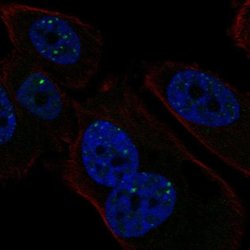 Invitrogen PMS1 Polyclonal Antibody 100 &mu;L; Unconjugated:Antibodies,