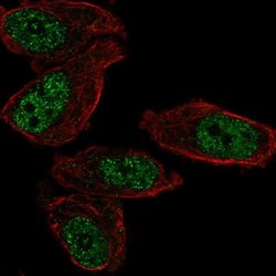 EGR2 Rabbit anti-Human, Polyclonal, Invitrogen 100 &mu;L; Unconjugated:Antibodies,