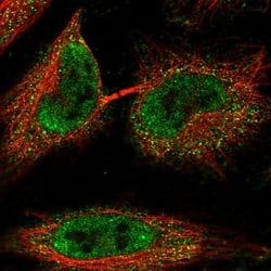 Invitrogen C1orf216 Polyclonal Antibody 100 &mu;L; Unconjugated:Antibodies,